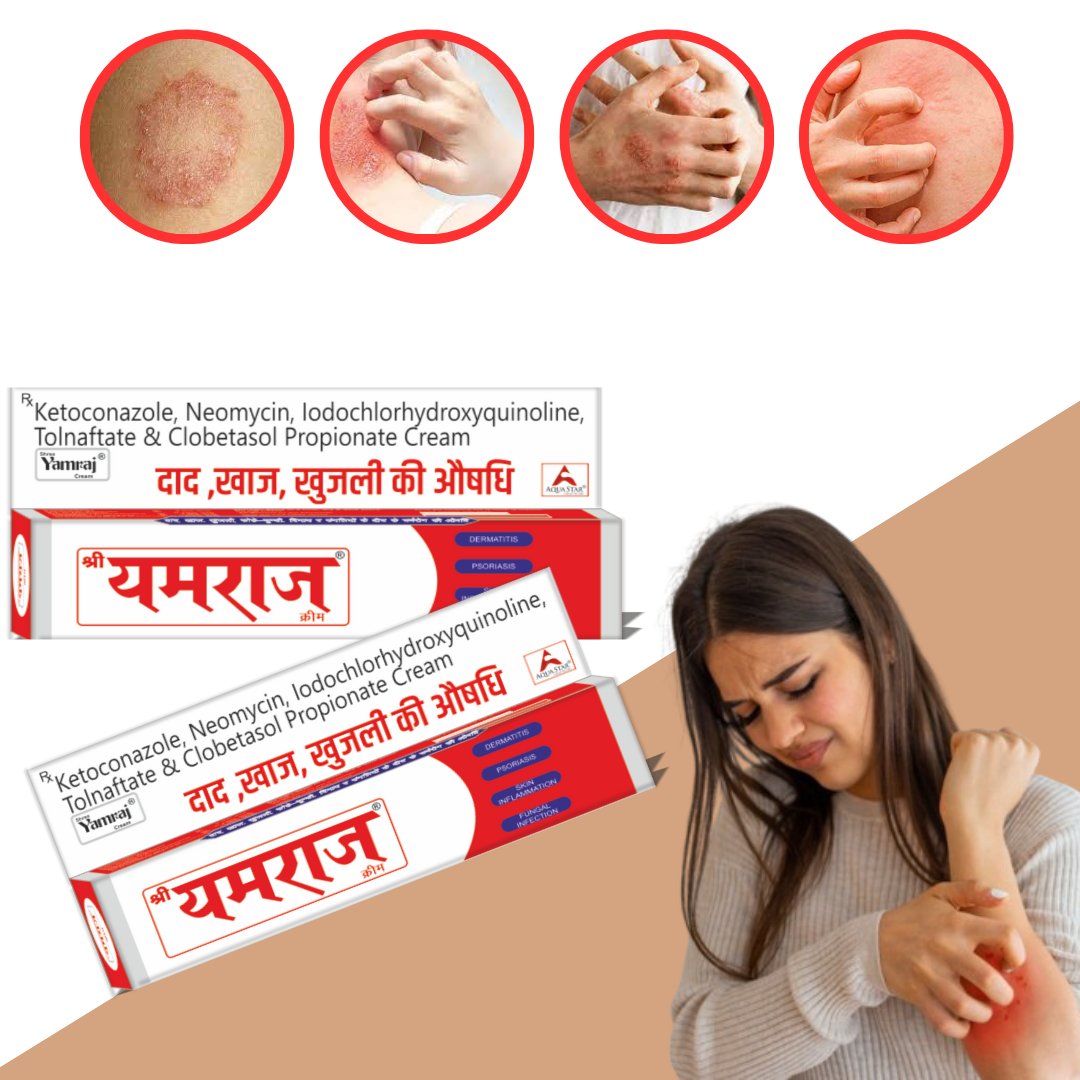 Shree Yamraj Cream - HIA for jungle infection 
